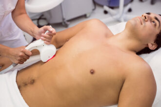 Épilation laser à Toulouse : ce qu'il faut savoir avant de se lancer
